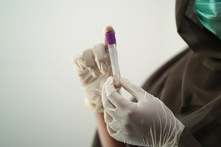 HIV-Selbsttest: Zeitfenster, CE-Kennzeichen und was nach einem Risikokontakt zählt - mediclife.de