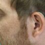 Tinnitus-Therapie - Tinnitus Noiser