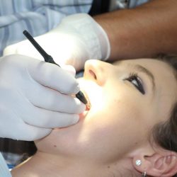 Professionelle Zahnbehandlungen in der Türkei